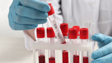 The Rising Demand for At-Home STD Check-Up Services in Dubai